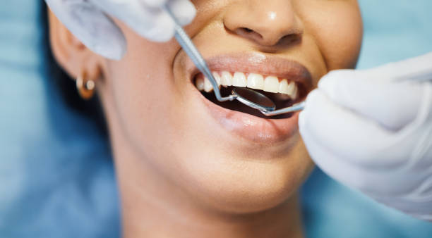 Best Emergency Wisdom Teeth Removal in Woodmont, CT